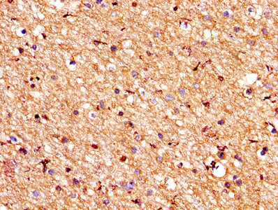 CSB-PA018754LA01HU