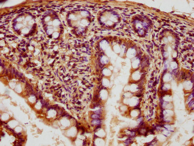 CSB-PA019235HA01HU