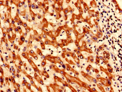 CSB-PA023018LA01HU