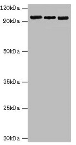 CSB-PA005574ESR1HU