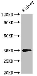 CSB-PA018779LA01HU