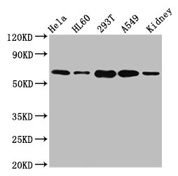 CSB-PA021368LA01HU