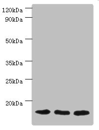 CSB-PA618983ESR2HU