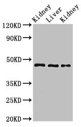 CSB-PA872420LA01HU