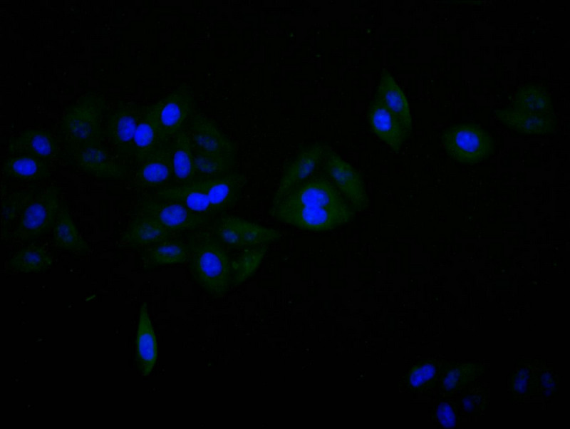 CSB-RA021912MA1HU
