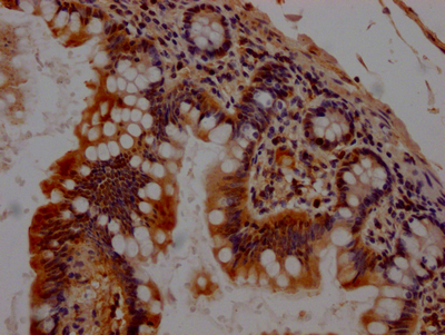 CSB-RA176809A0HU