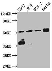 CSB-RA176809A0HU