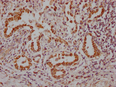 CSB-RA181189A0HU