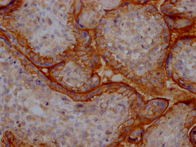 CSB-RA279866A0HU IHC