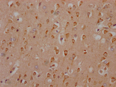 CSB-RA616248A0HU