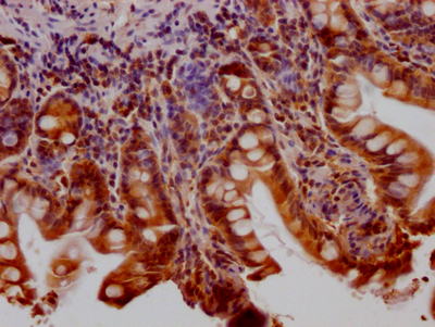 CSB-RA802195A0HU