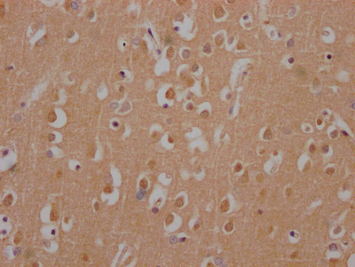 CSB-RA802195A0HU
