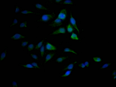 CSB-RA987582A0HU