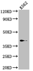 CSB-RA987582A0HU