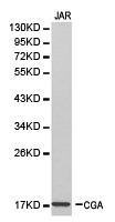 CSB-PA005293KA01HU