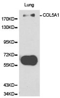 CSB-PA005748KA01HU