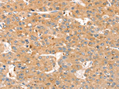 CSB-PA210932