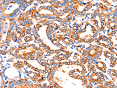 CSB-PA270601