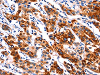 CSB-PA270601