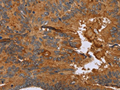 CSB-PA576836