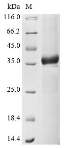 CSB-EP001311HU1
