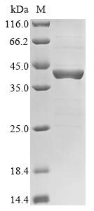 CSB-EP008828HU1