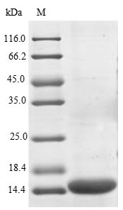 CSB-EP017667HU