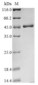CSB-EP622995HU