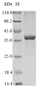 CSB-EP753711HU