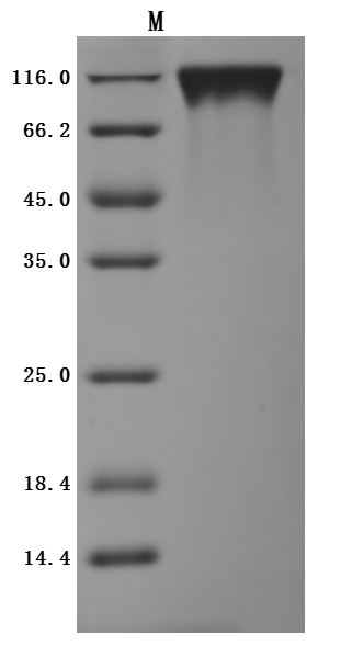 CSB-MP621519HU