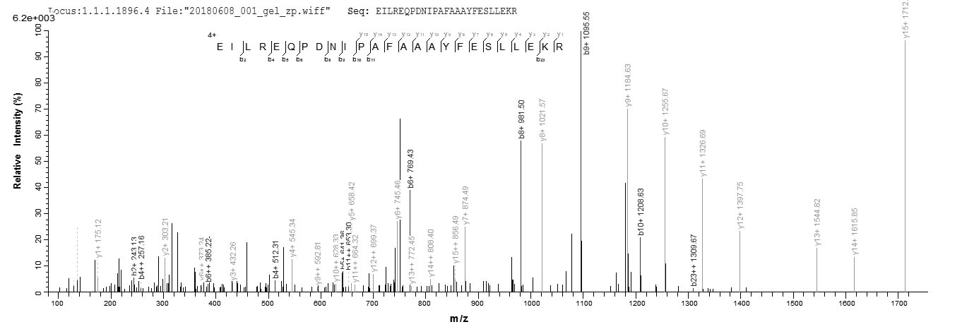 CSB-EP614892HU1