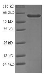 CSB-EP006638HU