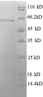 CSB-EP010239HU