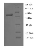 CSB-EP014790HU
