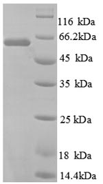CSB-EP025071HU1