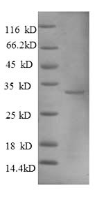 CSB-EP015107HU1